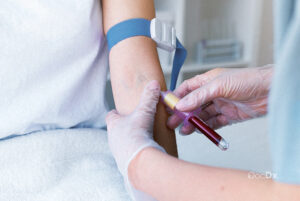 Blood Tests
