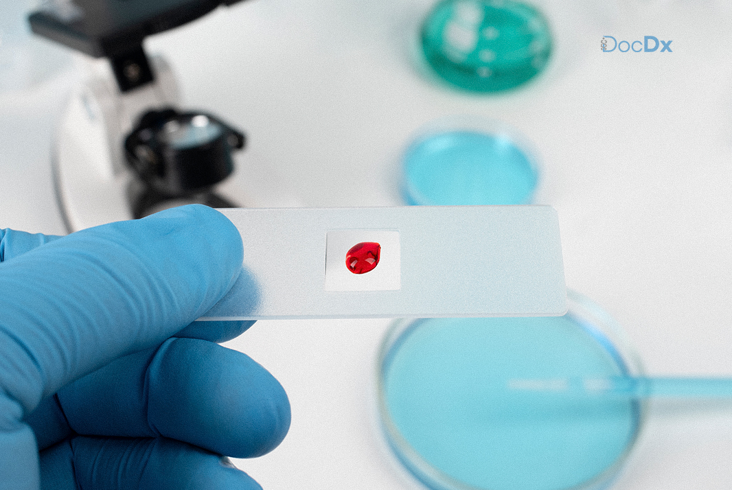 Early Cancer Detection Diagnostic Tests Blog Docdx